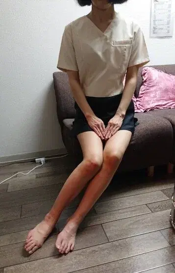 広瀬